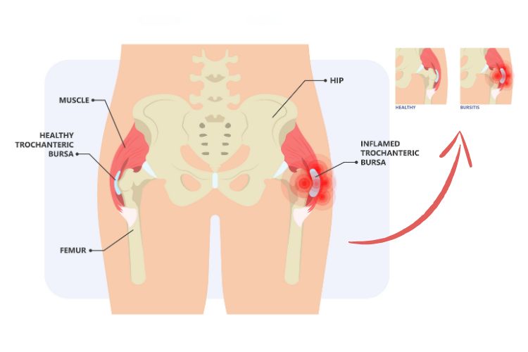 Hip Anatomy